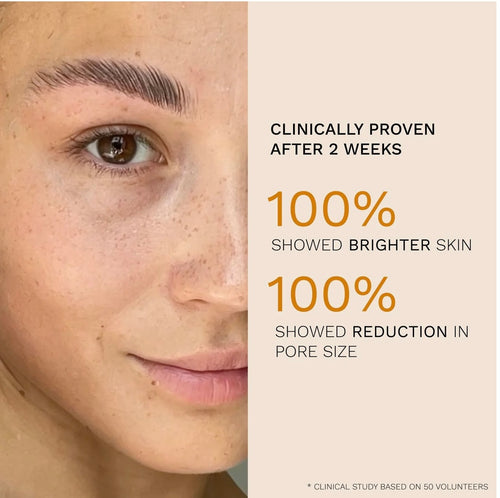 Ren Skincare Steady Glow Daily AHA Tonic